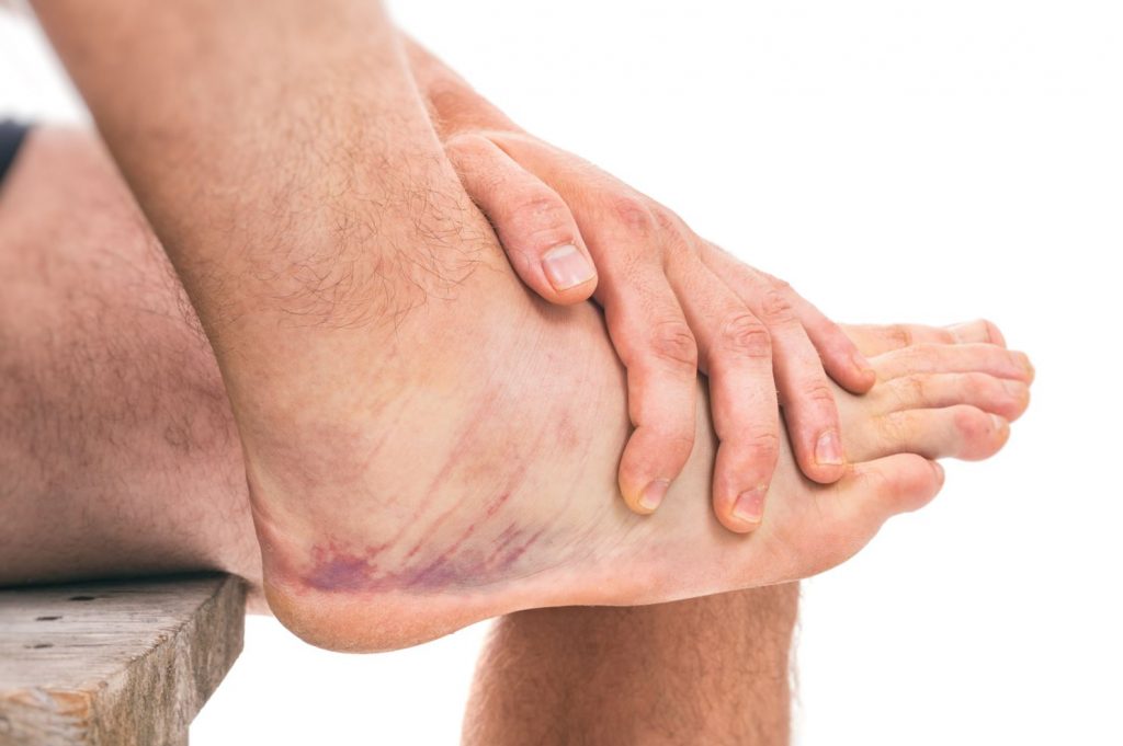 Signs and symptoms of ankle sprain. Straits Podiatry