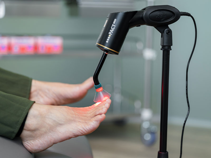 nail fungal treatment in singapore