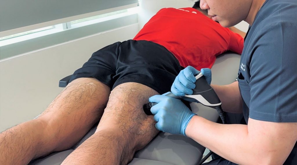 Radial Pressure Wave Therapy in Singapore (RPWT), treatment for muscular pain. Straits Podiatry