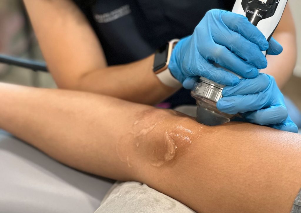 Rawatan untuk Lutut Pelari (Sindrom Kesakitan Patellofemoral)