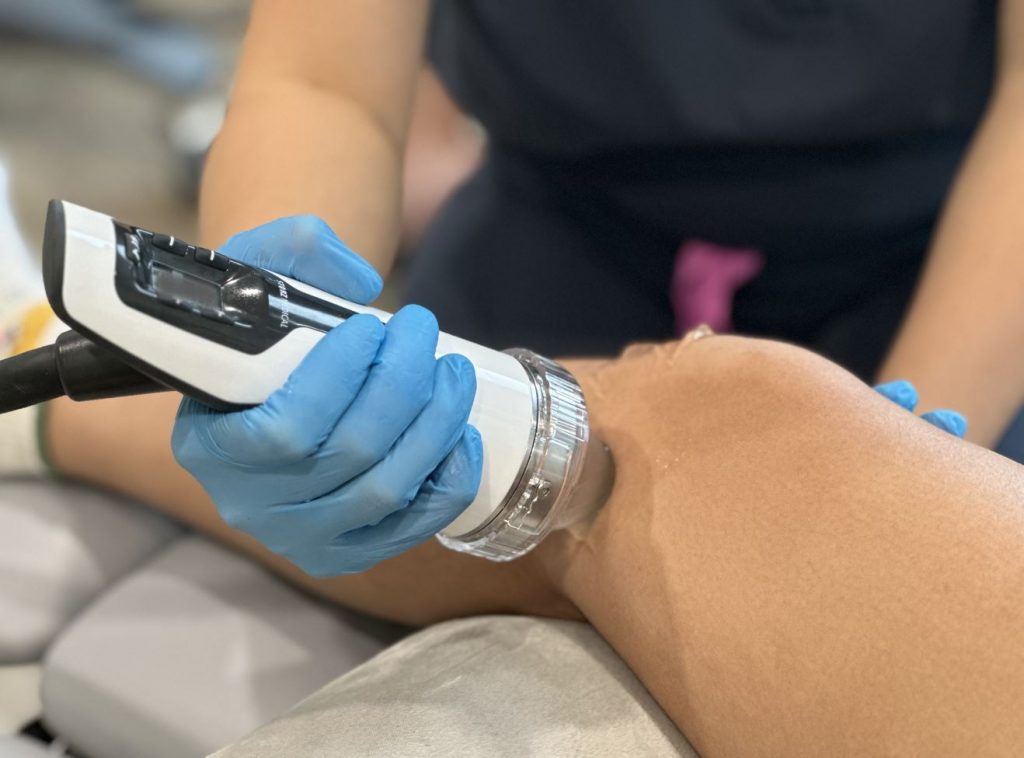 shockwave therapy for Meniscus tear on patient by podiatrist