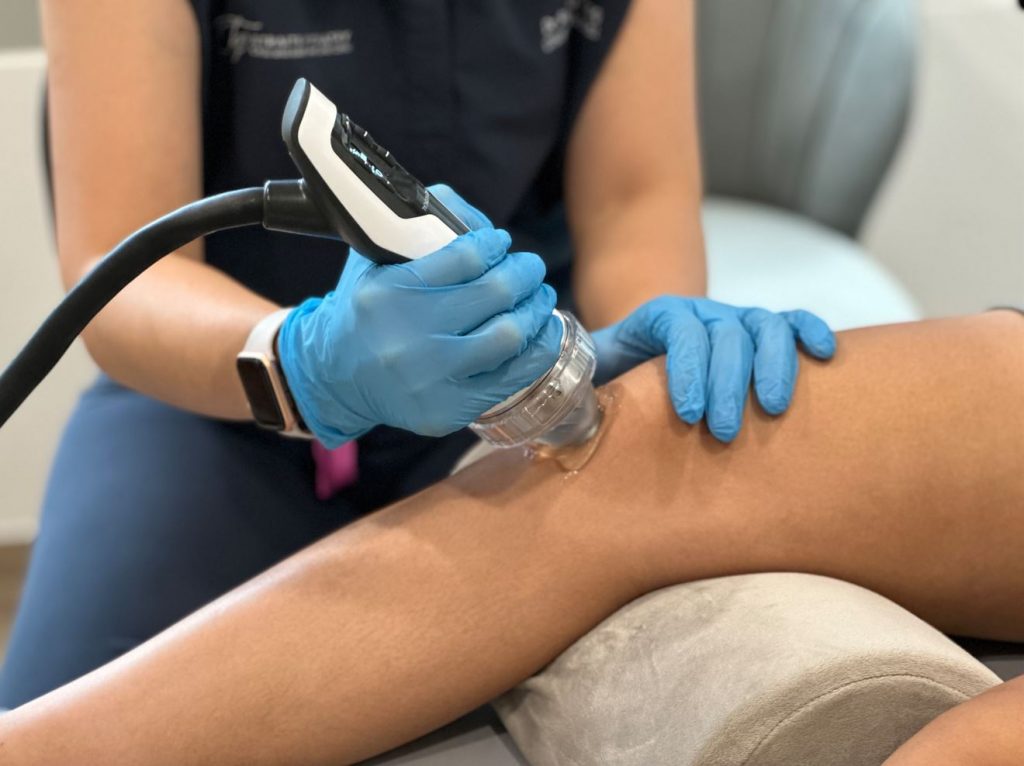 shockwave therapy for Patellar Tendonitis (jumper's knee)