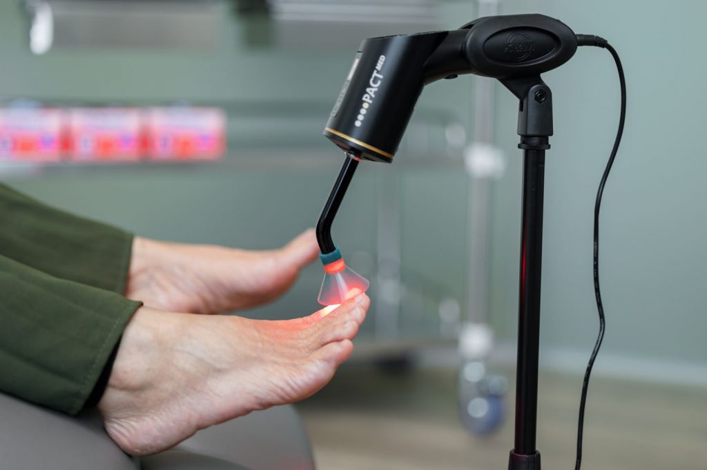 Terapi PACT di Straits Podiatry