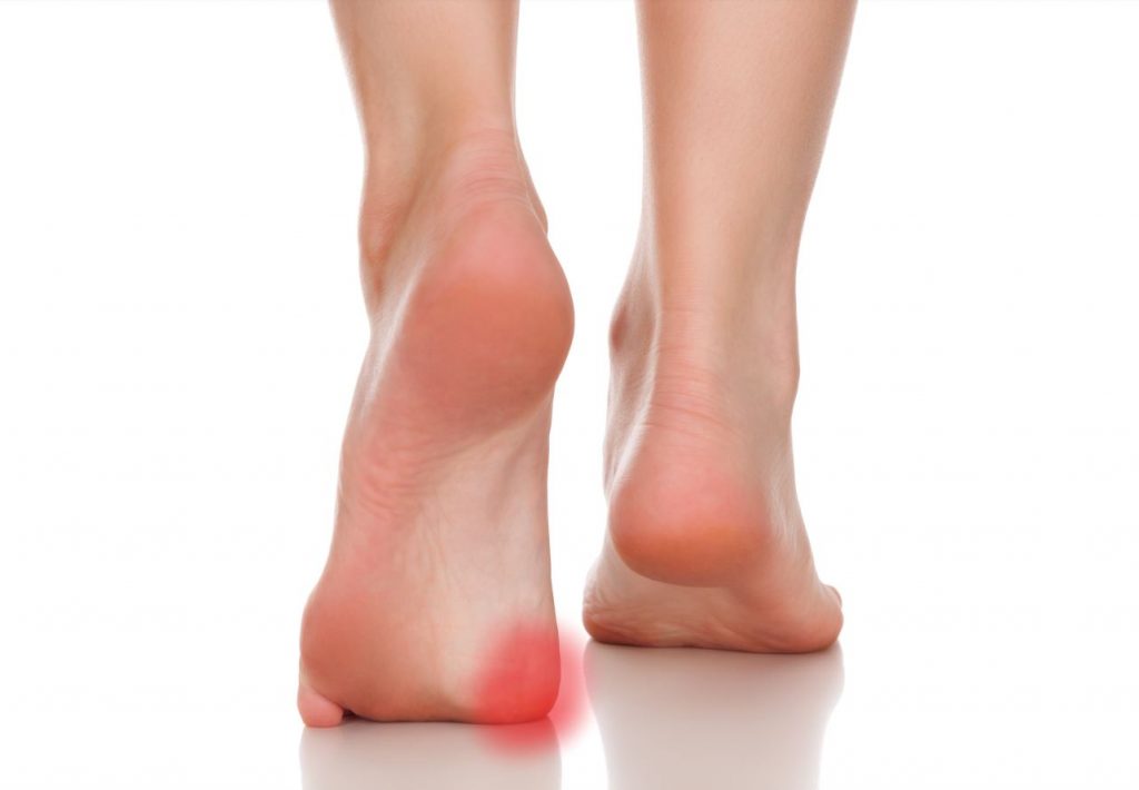 Sesamoiditis signs and symptoms. Straits Podiatry Singapore