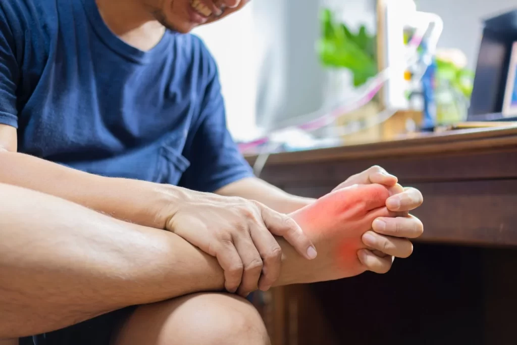 Artritis reumatoid di kaki