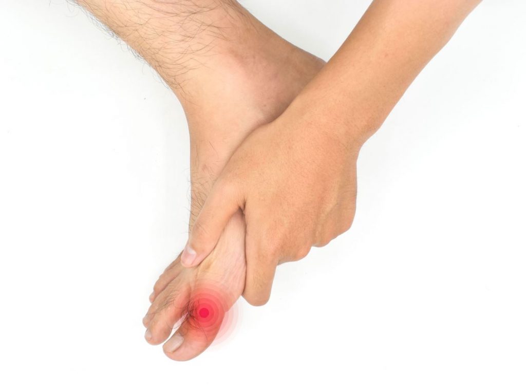 Signs and symptoms of hallux rigidus. Straits Podiatry Singapore.
