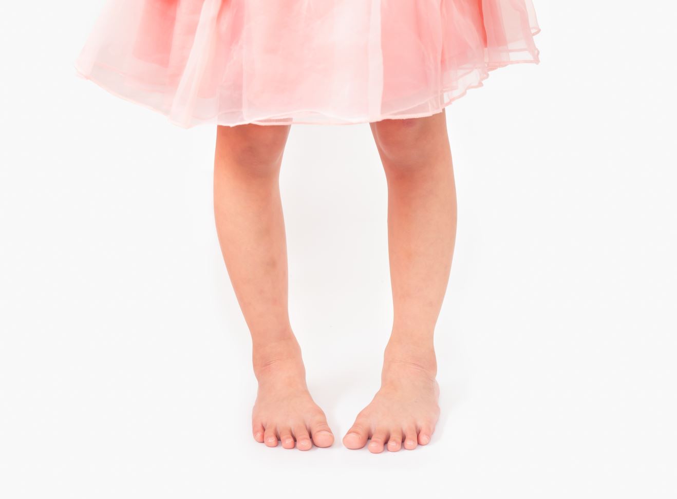 What is In-Toe Walking? What is Pigeon toed walking? Straits Podiatry