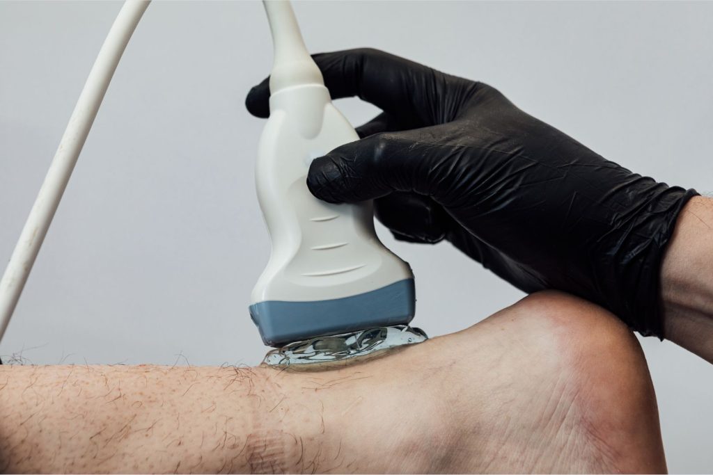 Functions of the Achilles Tendon. Photo showing a podiatrist at Straits Podiatry Singapore performing a diagnostic ultrasound scan on the Achilles tendon.