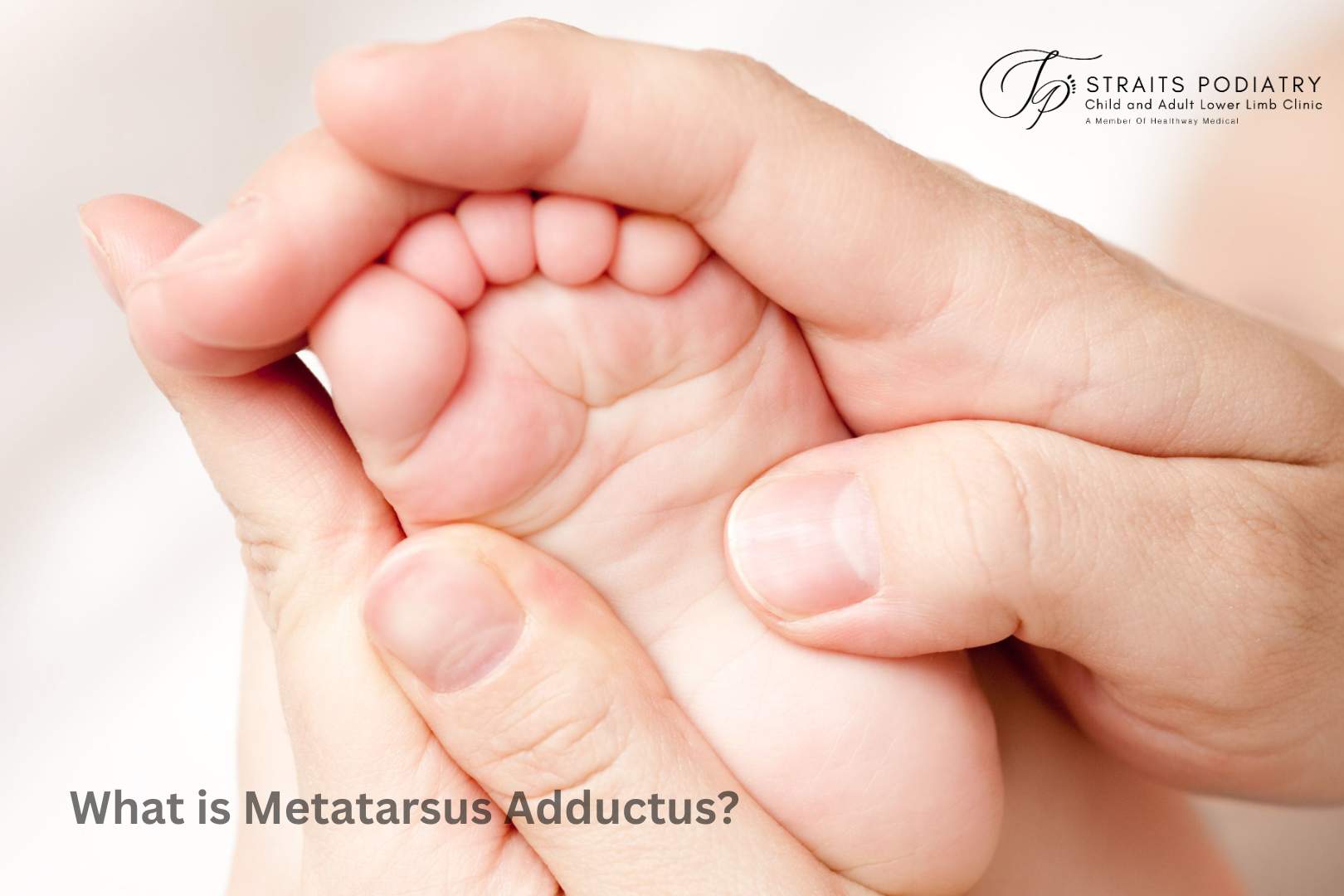 Bolehkah Metatarsus Adductus menjejaskan berjalan kaki anak anda? Straits Podiatry