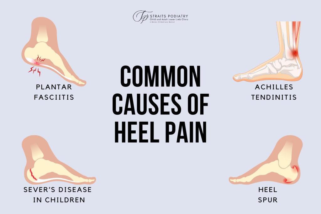足跟痛的原因。新加坡海峡足病诊疗所制作的信息图表显示了足跟疼痛的常见原因。