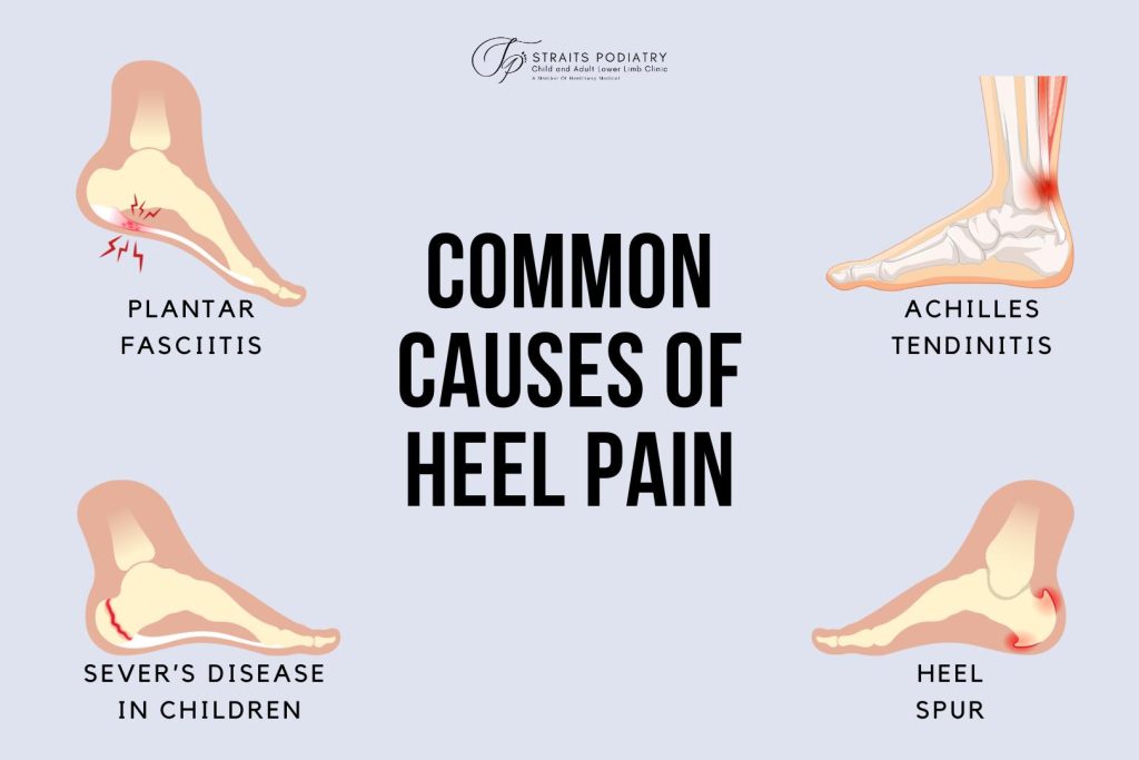 Punca kesakitan tumit. Satu infografik yang dicipta oleh Straits Podiatry di Singapura untuk menunjukkan punca biasa sakit tumit.