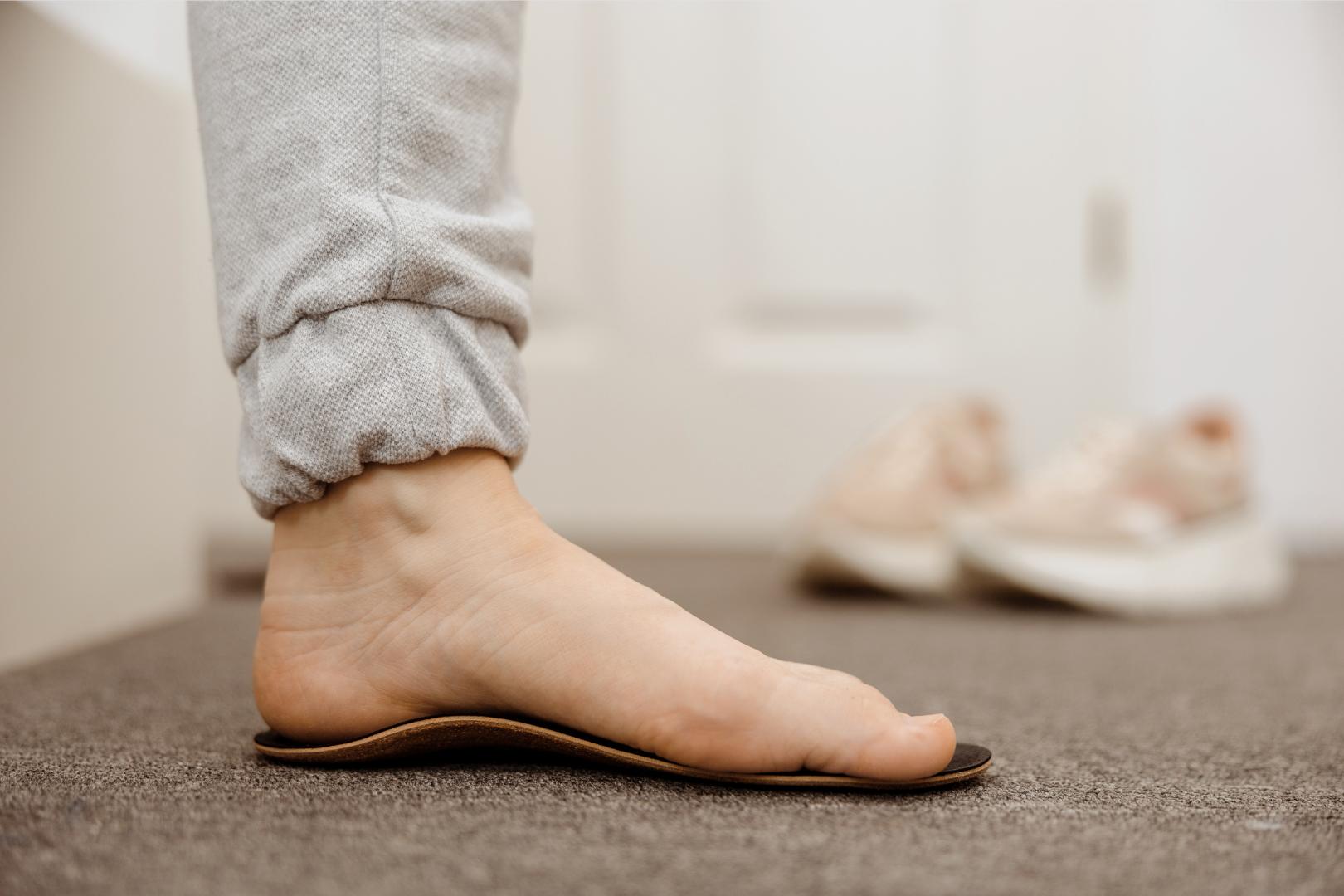 A photo showing a normal foot arch standing on an orthotic to manage plantar fasciitis. Straits Podiatry in Singapore.