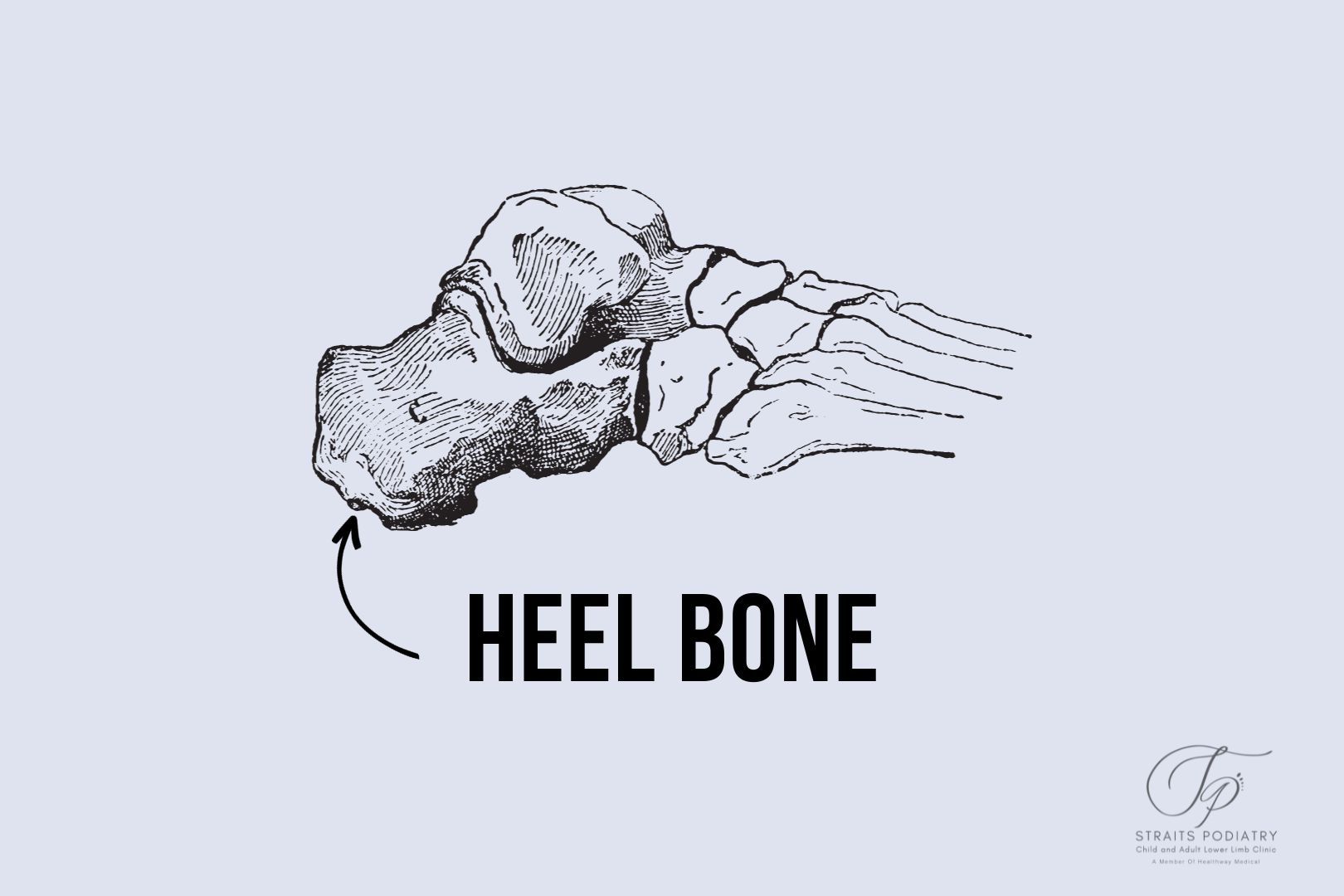 Anatomy of the heel. Photo showing the heel bone, or the calcaneus of the foot.