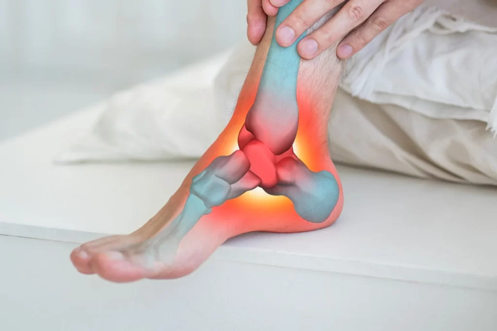 Ankle Injuries Causes