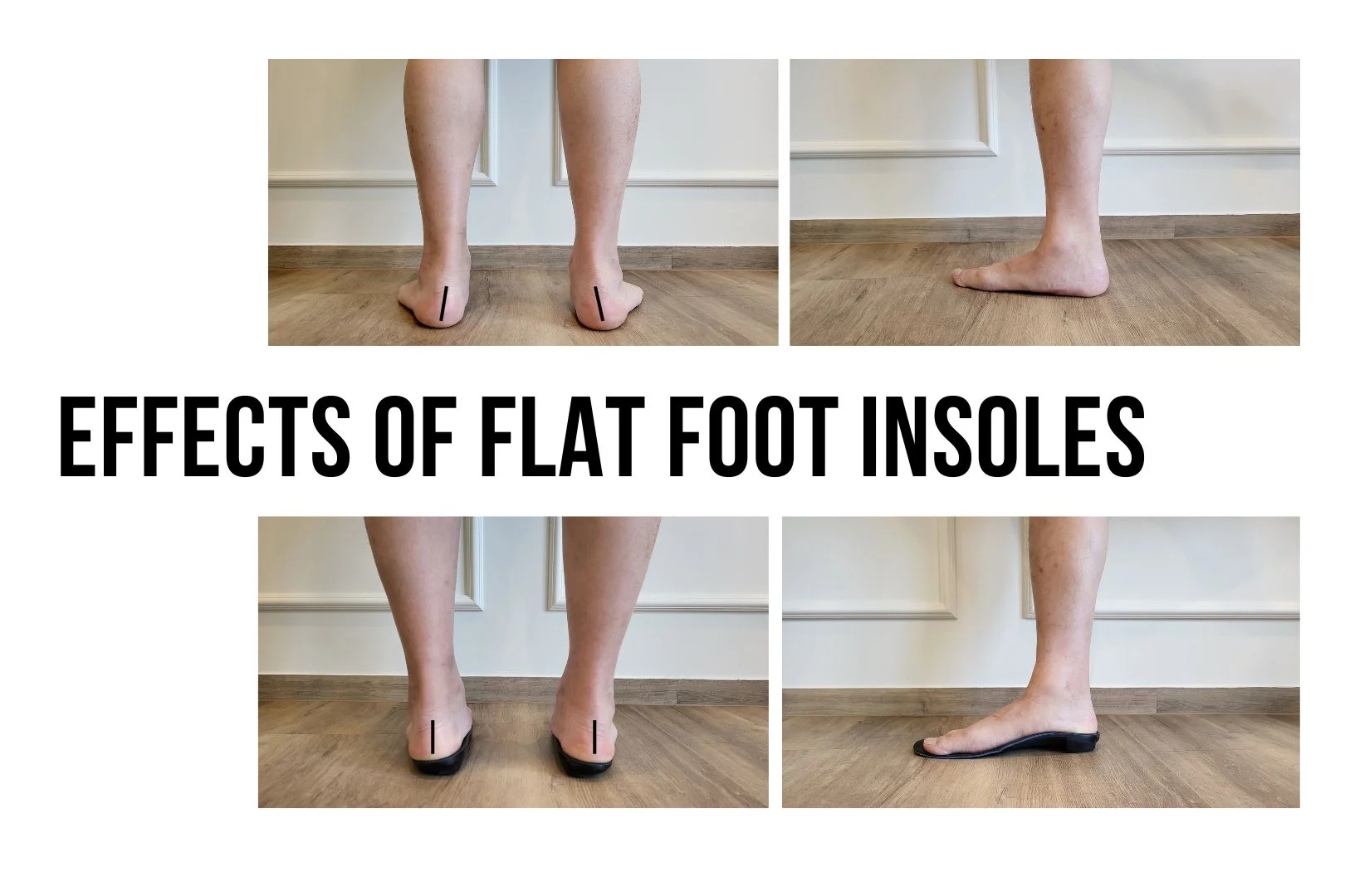 Effects of flat foot insoles