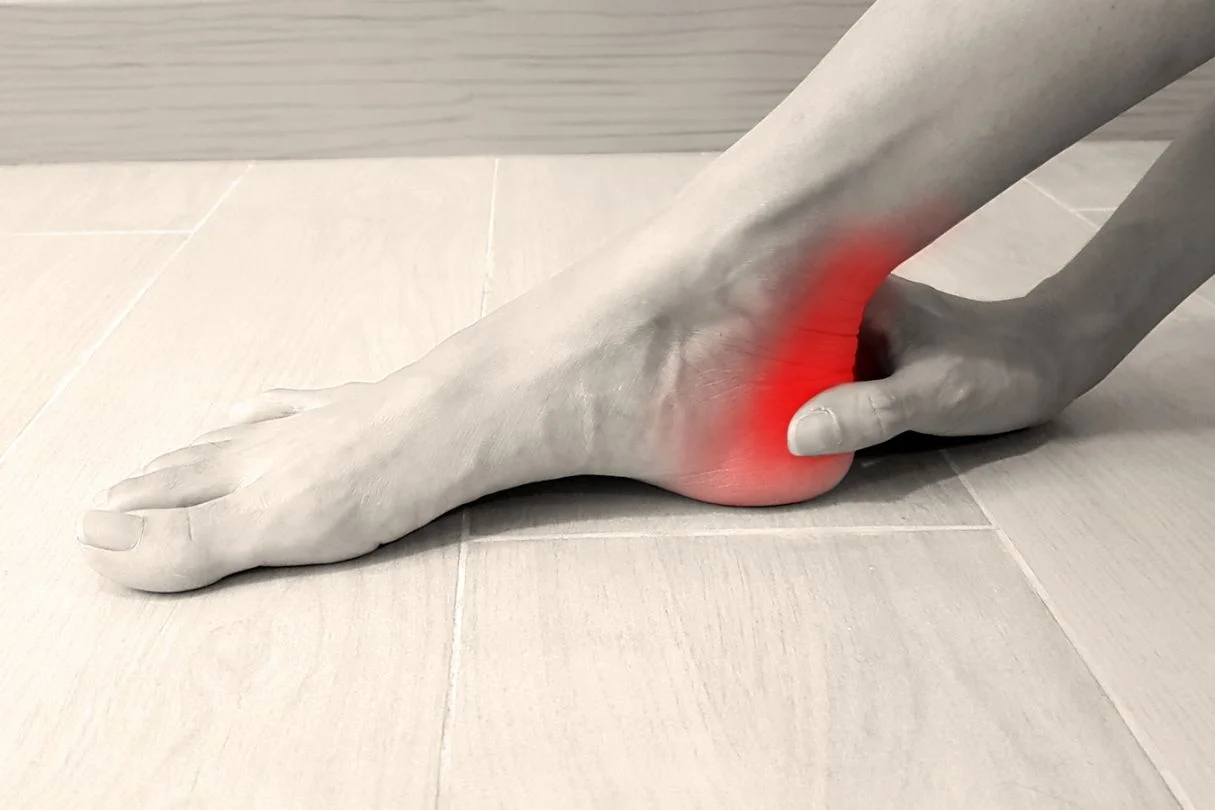 Posterior heel bursitis store